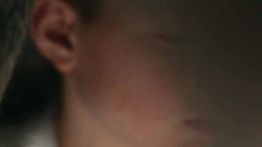 A freckle faced little boy looks sad
