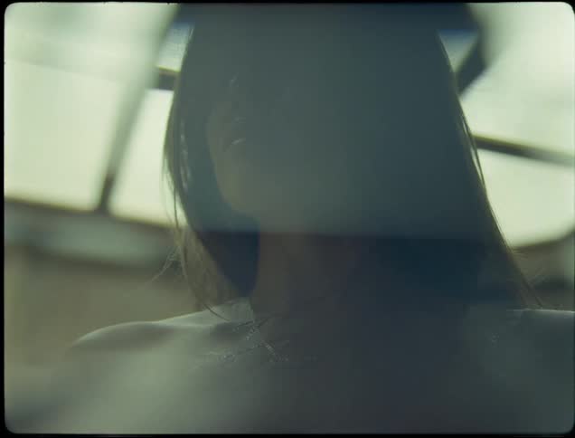 A woman with scars and marks from her neck to her chest and shoulder