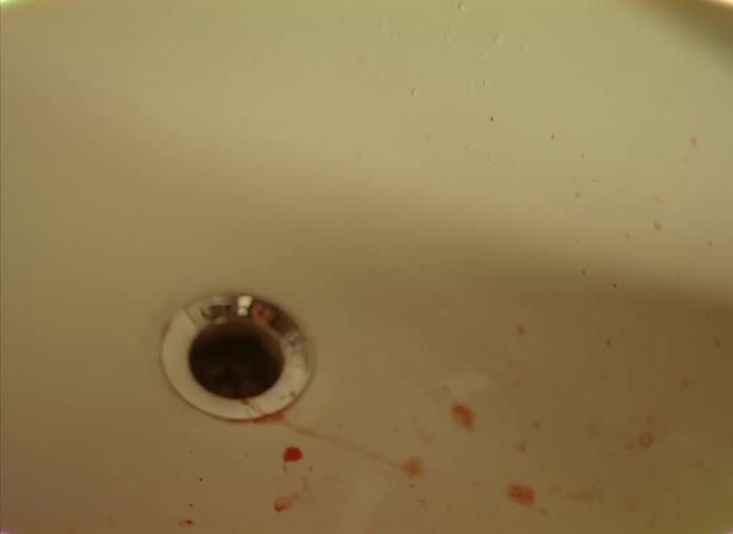 Close up of drops of blood falling inside a bathroom sink
