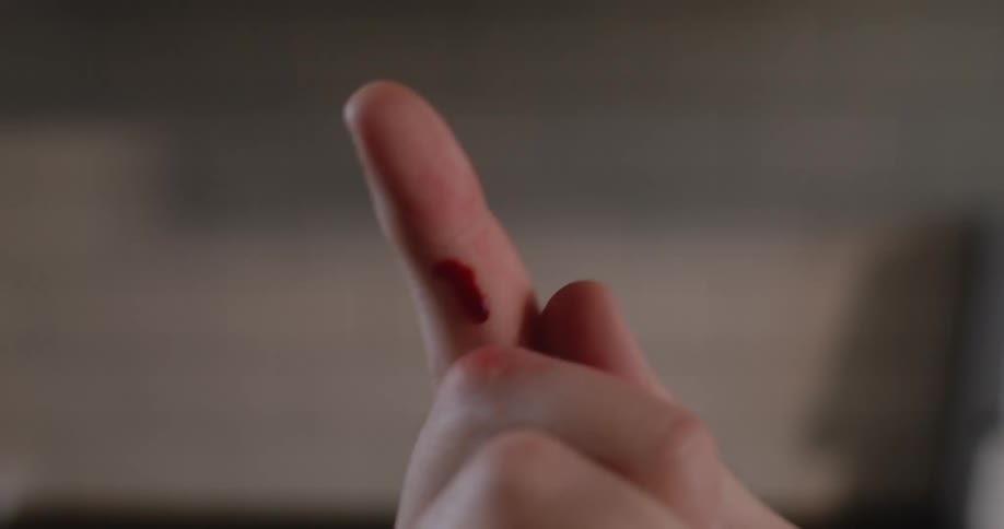 A persons finger is bleeding