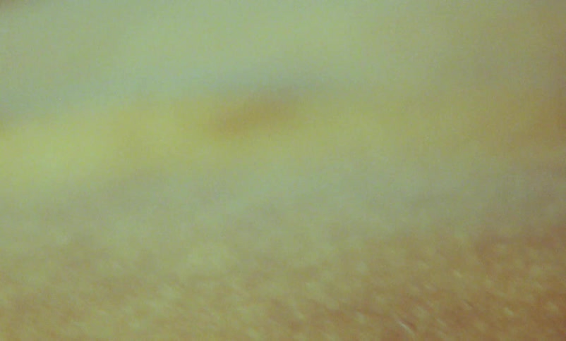 The light flashes on the persons skin