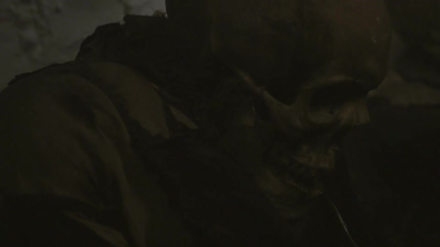 A skeleton is leaning forward