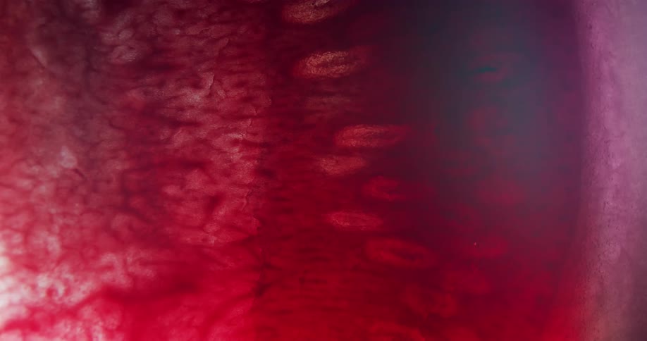 The red mixes with the white