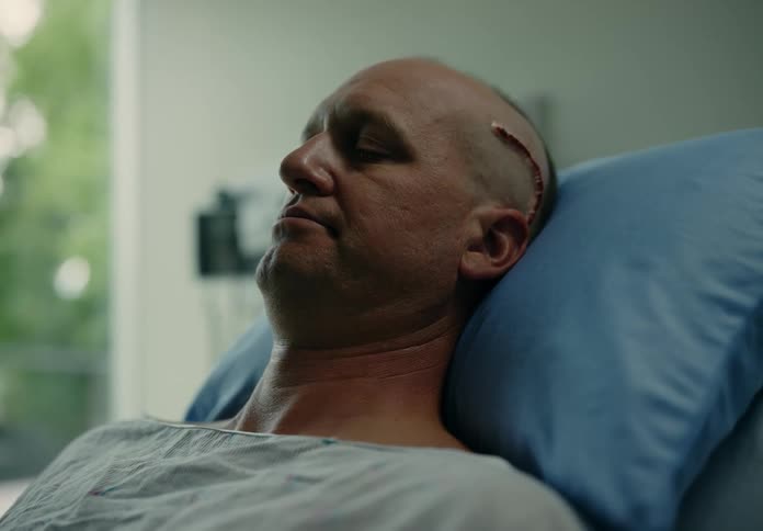 A male patient with a scar on his head in a hospital bed