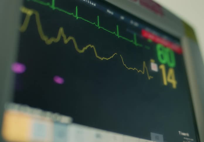 Lines on a graph move and numbers change on a hospital monitor