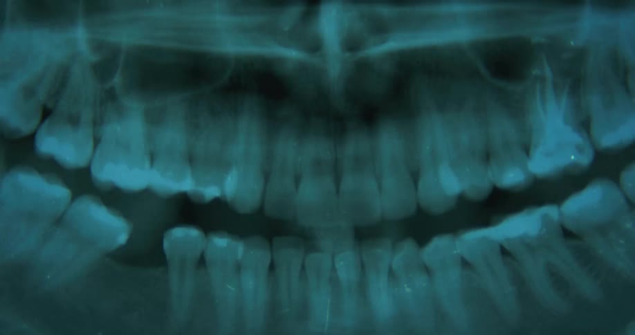 Someone is taking an x ray of some ones mouth