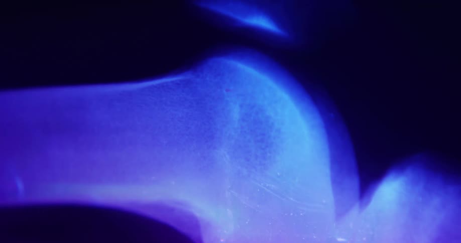 The xray is showing bones