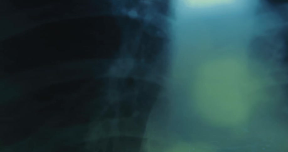 Close up of chest radiography