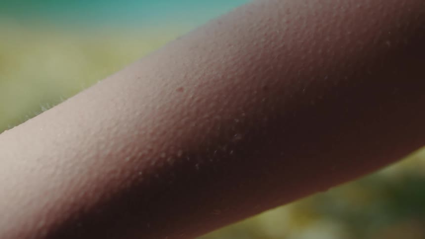 Close up of arm getting goose bumps