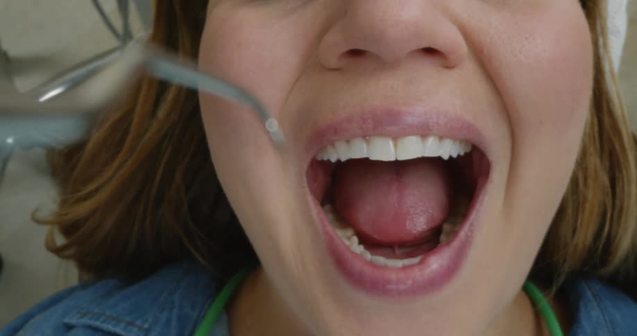 A woman is sitting in a dentists chair and she opens her mouth wide as a dentist starts working on her