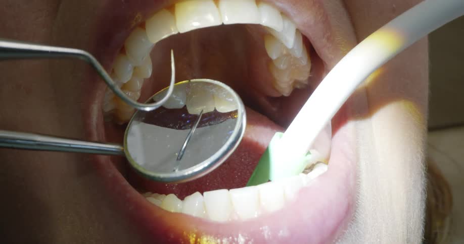 Dentist treats female patient using mouth mirror and explorer