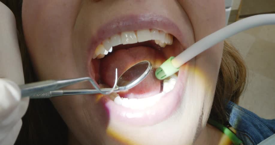 A woman getting her teeth worked on at a dentist