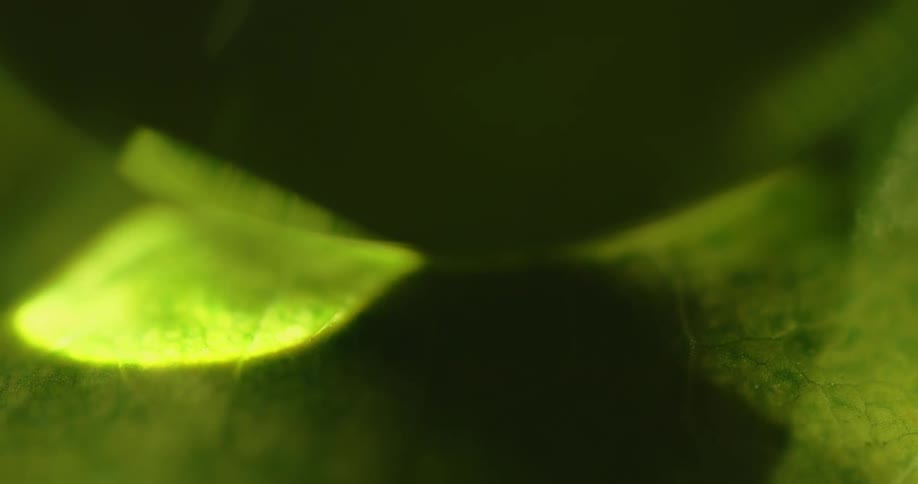 A closeup of a textured green surface has a bright focused light pass over it