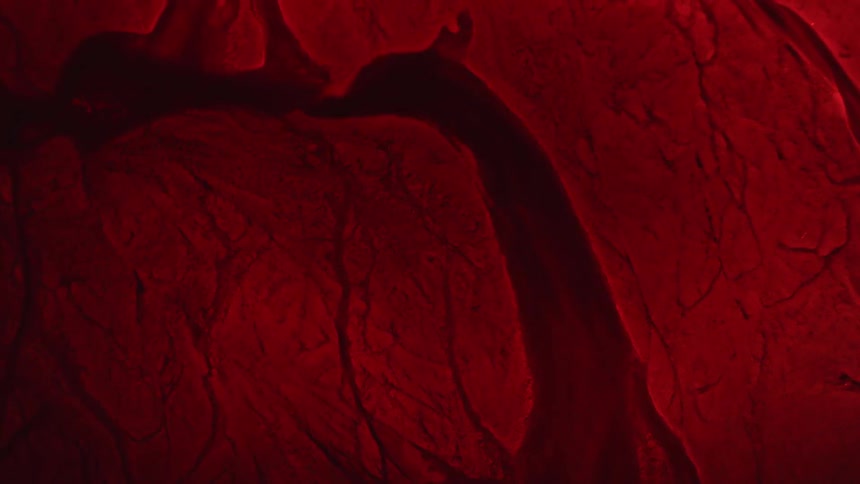 The blood vessels are moving