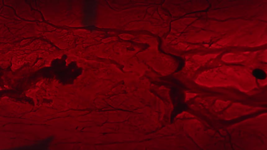 The liquid pushes through the veins