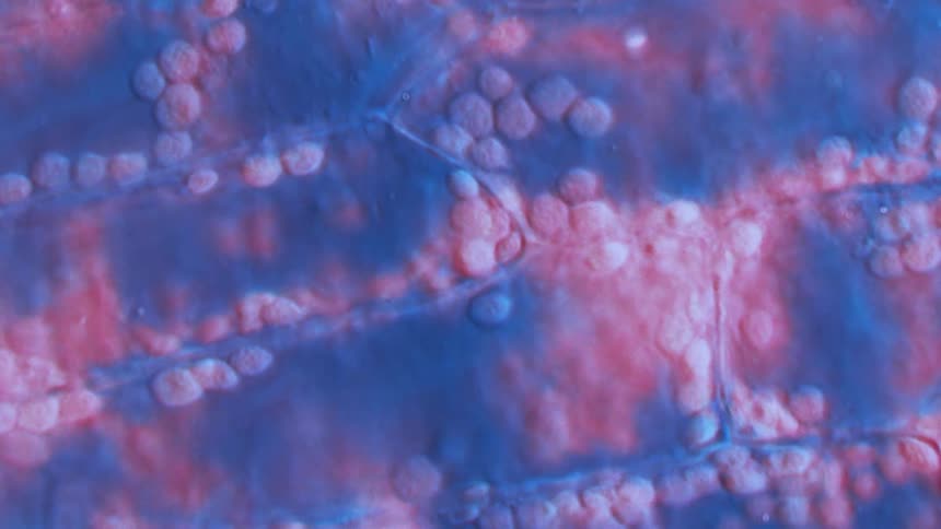 A microscopic views of cells moving in the body