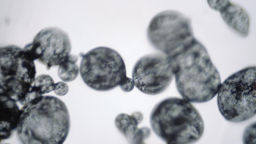 Black spheres wiggle and grow smaller and larger under a microscrope