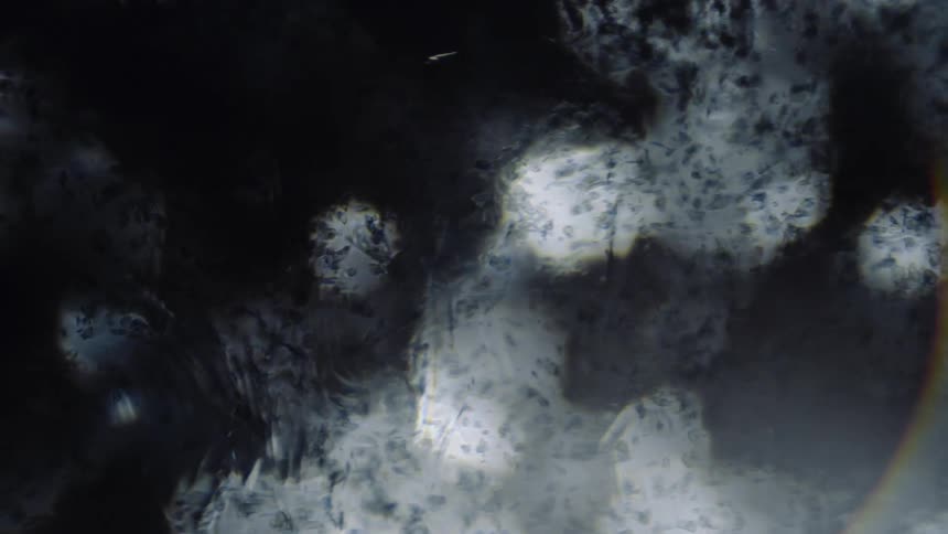 Gray specks float in a translucent gel like liquid