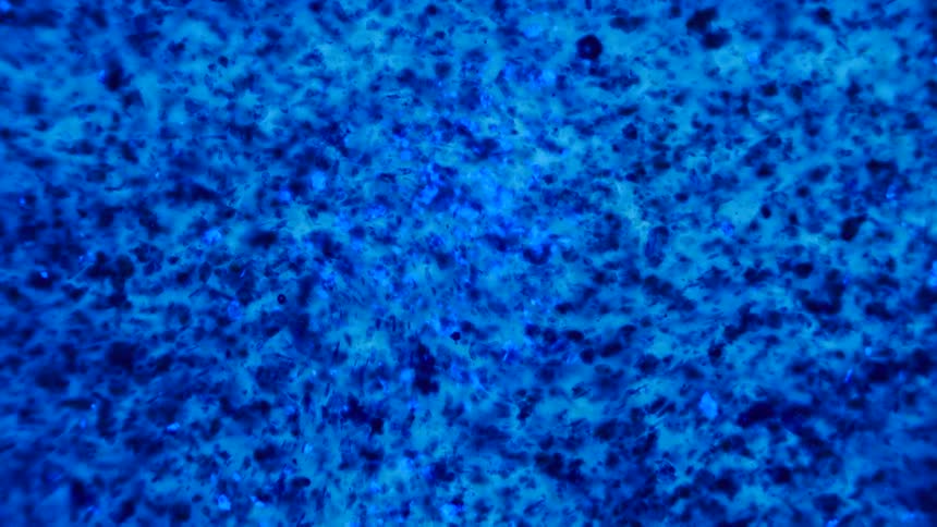 The blue dots float in the liquid