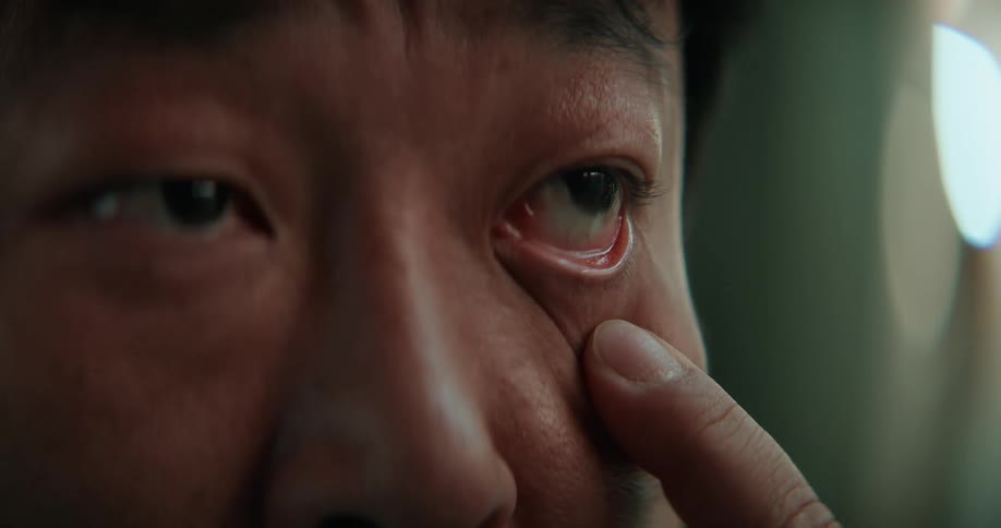 A man puts his finger under his eye and pulls down the skin