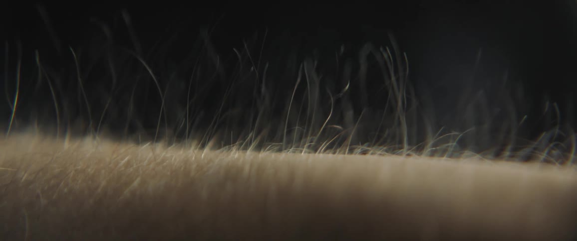 Hair rising on a persons arm