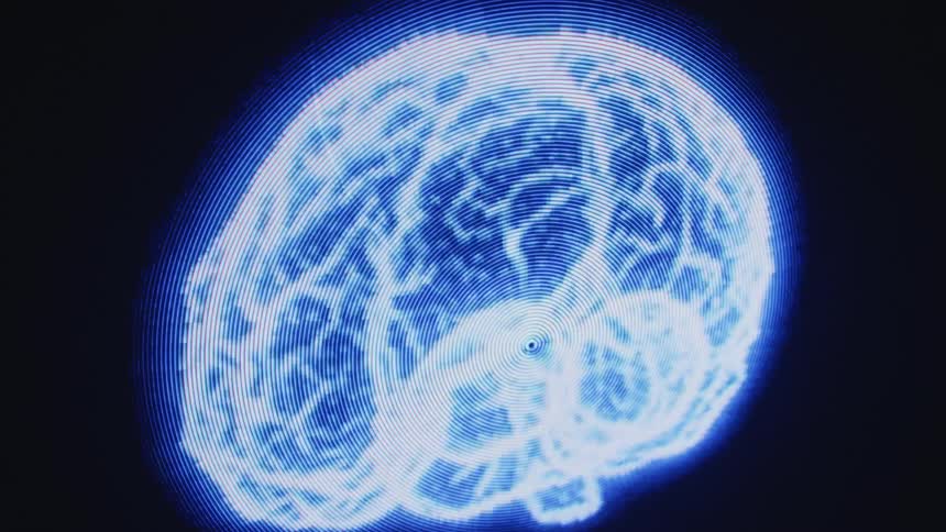Text explodes into the shape of a brain on a computer monitor
