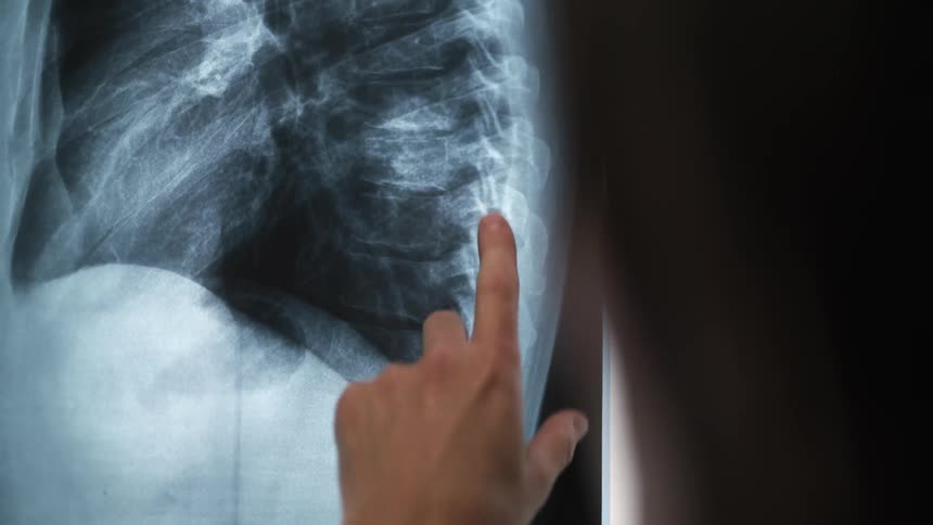 A close up of a womans face as she points to an x ray image on the screen
