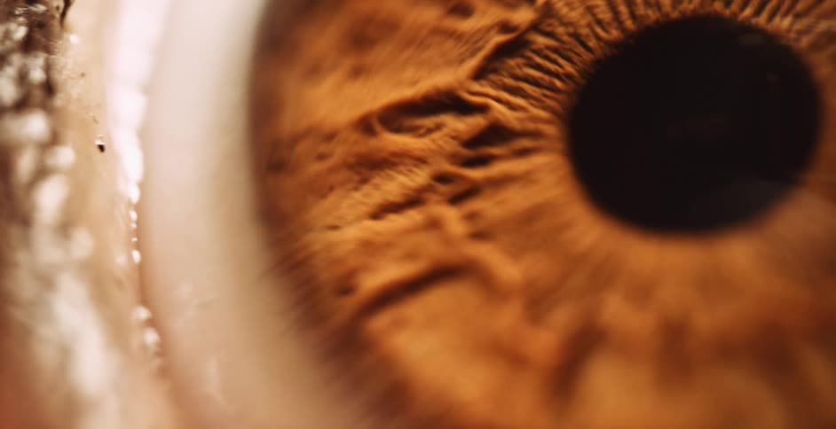 Eyelid rises on eye allowing more white to show around textured brown iris and black pupil