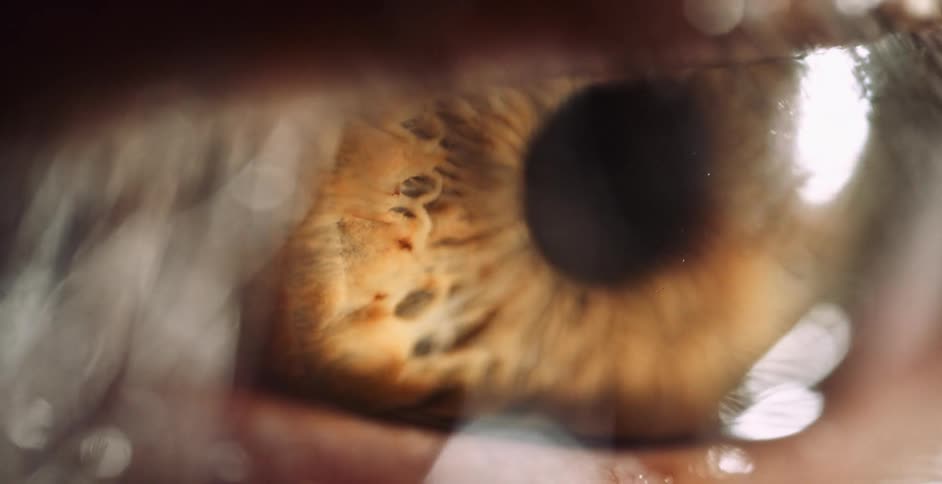 A microscopic view of a persons eyeball as it slowly blinks and dark shadows cross over it
