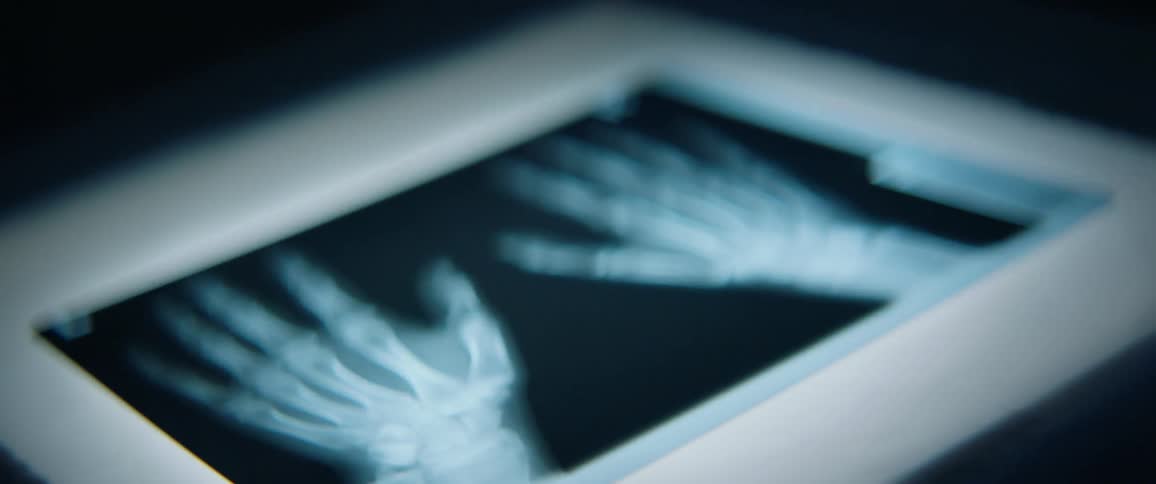 An x-ray of a pair of hands