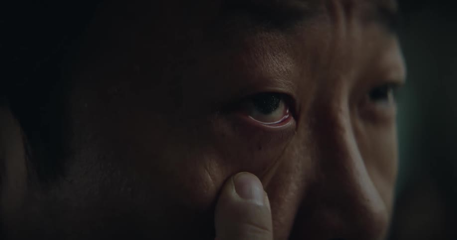 A man is examining his eye