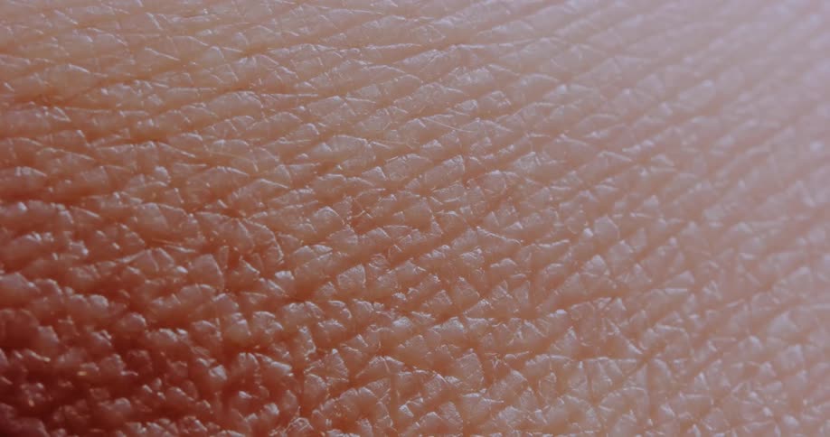 A close up of dry human skin