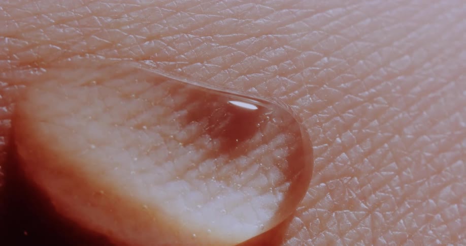 Light shines on a water droplet as it jiggles and moves on a persons skin