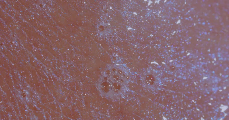 A close up of a persons skin with a glittery substance bubbling on it