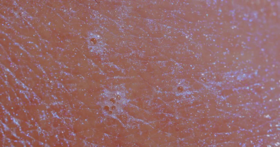 Human skin is marked with dry patches