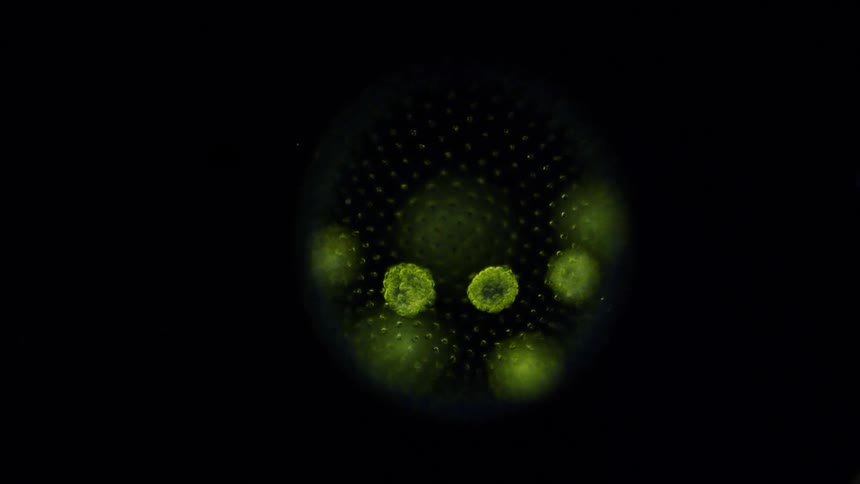 Green algae is examined closely under a microscope showing organic structure