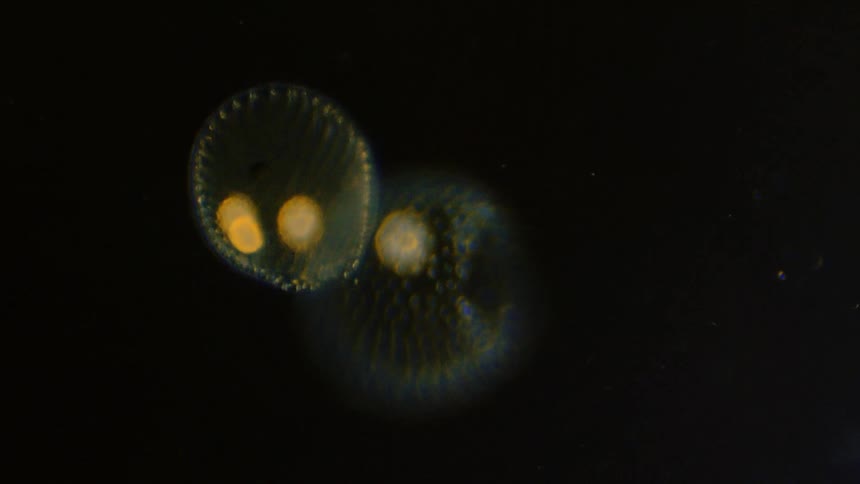 Alien like spheres with small and large spots rotate and float against blackness