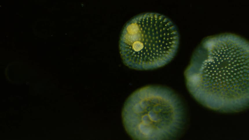 Speckled, spiked spheres with bubbles glow while floating across dark under a microscope