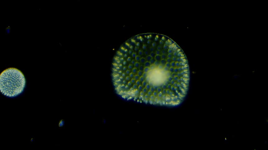 The cells and microbes float around in the liquid under a microscope