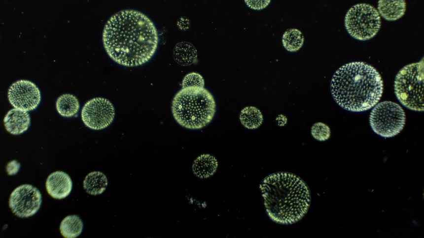 Green algae is seen under a microscope