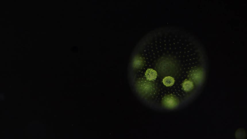 Beautiful green colored cells and bacteria are being examined under a microscope