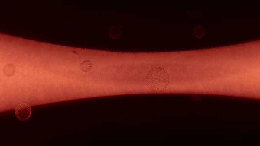 A virus seen under a microscope