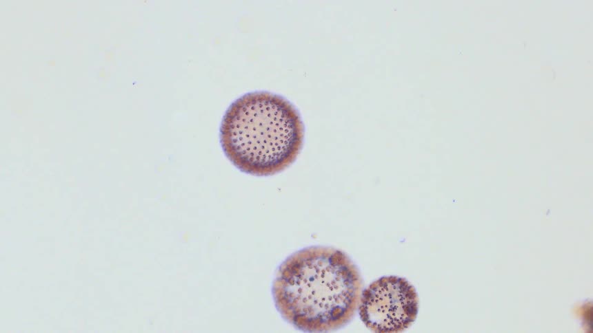 Small virus or covid like cells are seen under a microscope
