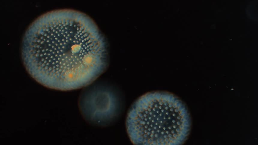 Glowing blue algae come into focus under a microscope