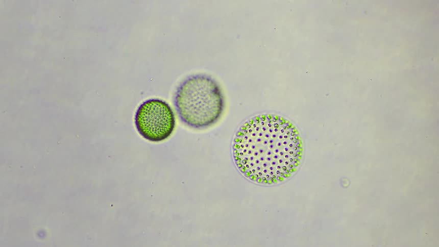 Cells move under a microscope