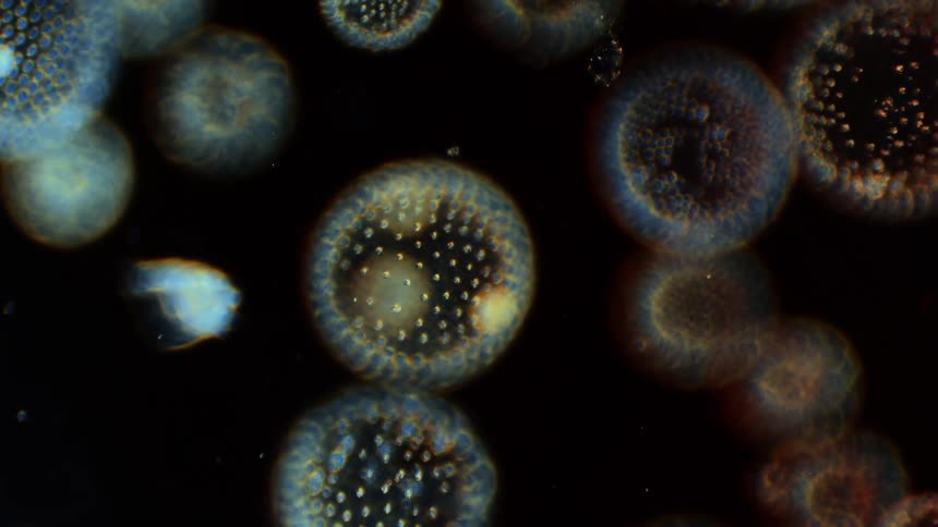 Incredible algae and other cells float against black background
