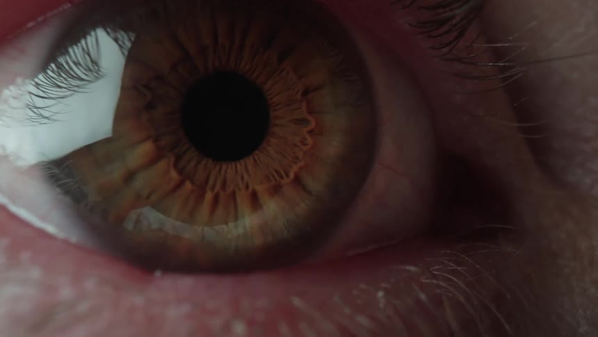 Eyelid rises to allow hazel eye to reflect the light