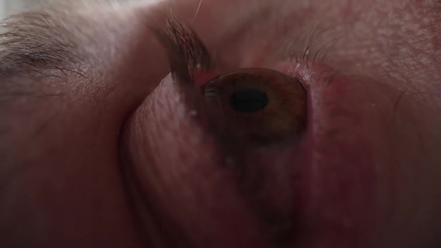 Persons eye blinks open and stares around