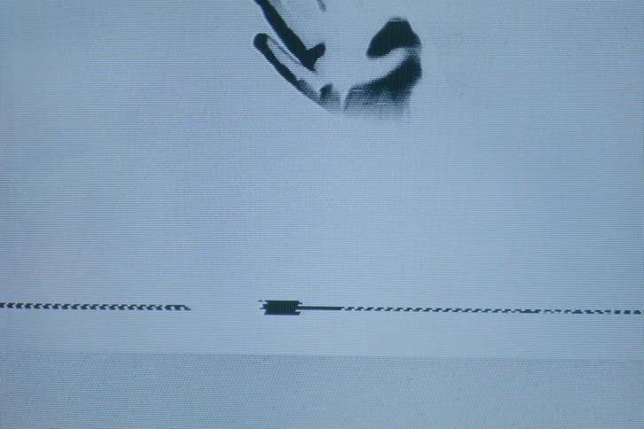 A hand moves on the static filled television