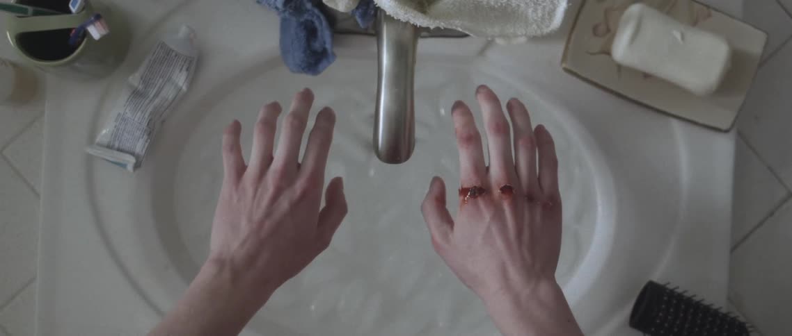 Persons hands with skinned knuckles hover over sink full of water and ice